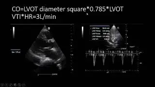 How to increase oxygen delivery by 3 times in hours by critical care U/S and simple tests in shock