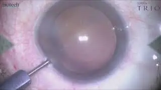 Optiflex TRIO
