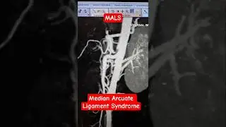 CT Abdominal Angiography