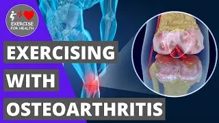 Osteoarthritis and how staying active can help with your joint pain