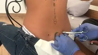 Piercings Microdermals en caderas  2022