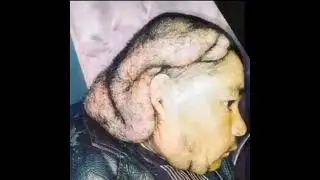 1 hour of nothing occasionally broken by Tumor Guy