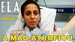 Quando vi a MÃO dela ATROFIADA fiquei DESESPERADO