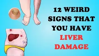 Warning: 12 Weird Signs That Show You're Having Liver Damage | CHROMOSOMIUM
