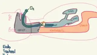 PALS 02: Airway