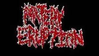 Artery Eruption