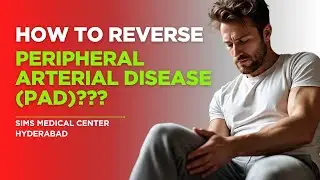 How to Reverse Peripheral Arterial Disease with Integrative Treatment | SIMS Hyderabad