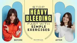 Heavy Menstrual Bleeding Causes How to Stop Menorrhagia Naturally?