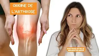 Quelles sont les facteurs de risques de développer de l'arthrose ?