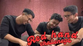 Red hand challenge |hickey| Tushar Sachdeva