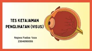 Praktikum Ketajaman Penglihatan (Visus)