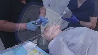 L'assistance à l'intubation