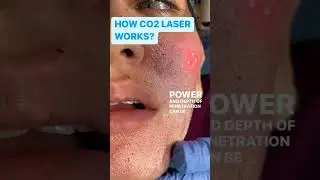 co2 Resurface , m&eacute;todo de rejuvenescimento Facial @CanalUSP @helltatto