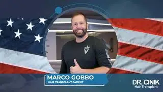 Marco Gobbo Hair Transplant Journey Review | Dr. Cinik Hair Hospital