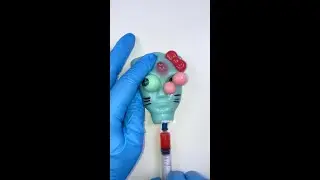 Reusable toys to squeeze acne #stress relief #stress relief toys #squeeze acne for stress relief
