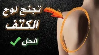 حل وعلاج لتجنج الكتف - Fix Scapular Winging