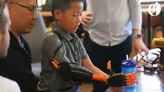The first 3D-printed prosthetic arm by an Oregon hospital