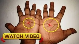ONLY 3% OF PEOPLE HAVE THE LETTER X ON THEIR BOTH HANDS. HERE&rsquo;S WHAT IT MEANS ABOUT YOUR DESTINY!