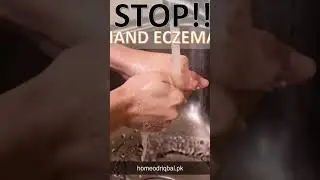 🌿 STOP Hand Eczema &ndash; Heal Your Hands Naturally! ✋💧
