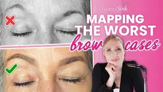 How to map the worst brow cases