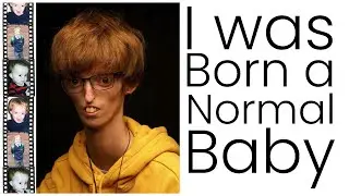 I was Born a Normal Baby, then Everything Changed - Dylan Lombard