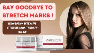 ⛔️Say Goodbye to Stretch Marks! I Skinception Intensive Stretch Mark Therapy Review I ⛔️
