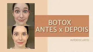 ANTES E DEPOIS DO PROCEDIMENTO EST&Eacute;TICO #shorts