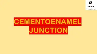 CEMENTOENAMEL JUNCTION