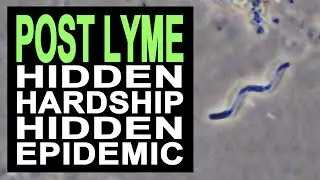 Post Lyme Trailer - Free Lyme Disease Documentary