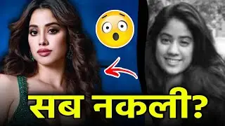 चेहरा बर्बाद कर लिया? 😱 20 Bollywood Stars Plastic Surgery FAILS! (Shocking)