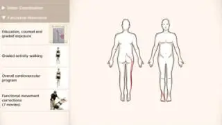 #PlayThatPattern: Generalized Low Back Pain