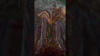 Patient 13 is hungry