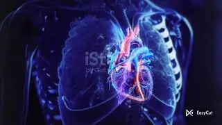 Angiography Procedure Step by Step | Technician Training | Cath Lab Academy