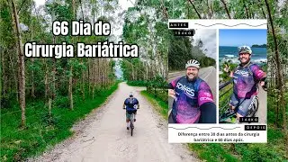66 Dias Ap&oacute;s a Cirurgia Bari&aacute;trica- RAFAEL OBELIX