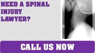 Best traumatic brain injury Lawyer Greater London