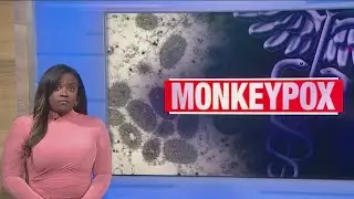 University of Illinois prepares to fight the spread of monkeypox