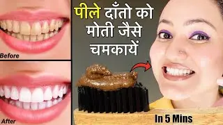 HOMEMADE *AYURVEDIC TOOTHPASTE* for TEETH WHITENING मोती जैसे चमकेंगे पीले दांत इस घरेलू नुस्खे से💕