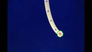 Video 3 out of 4 - High Speed Vision-Based Algorithm for Catheter Centreline Extraction