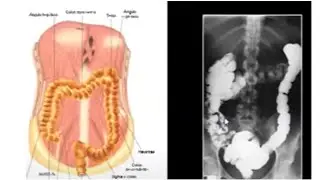 Anatomia Radiológica do Abdome