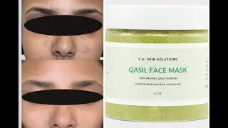 QASIL Face Mask For Flawless Skin ! | E.A. Skin Solutions
