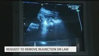 Gov. Reynolds asks Iowa Supreme Court to lift injunction on fetal heartbeat bill