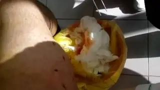 Гнойник