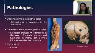 Introduction to Human Osteology  | Lecture 6.02 | SCHG_FOC22_IHO | Palaeopathology