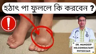 Leg Swelling (Edema): Symptoms, Causes & When to See a Doctor