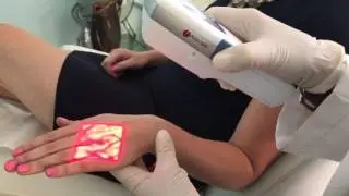 AccuVein to Prevent Bruising Before Treatment at The West Institute
