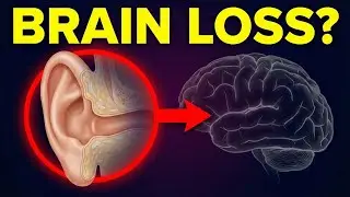 Ignoring This Hearing Change Shrinks the Brain | Bright sense senior health video