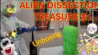 UNBOXING ALIEN TREASURE | ABRIENDO MI JUGUETE DE EXTREASURE | TREASURE X ALIENS TOYD