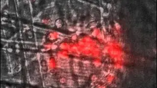Leucocyte extravasation following inflammation