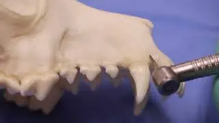 Want to know about Mesial and Distal Bone Tooth Interface ?