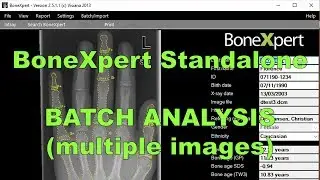 BoneXpert Standalone: How to do a batch analysis (multiple images)